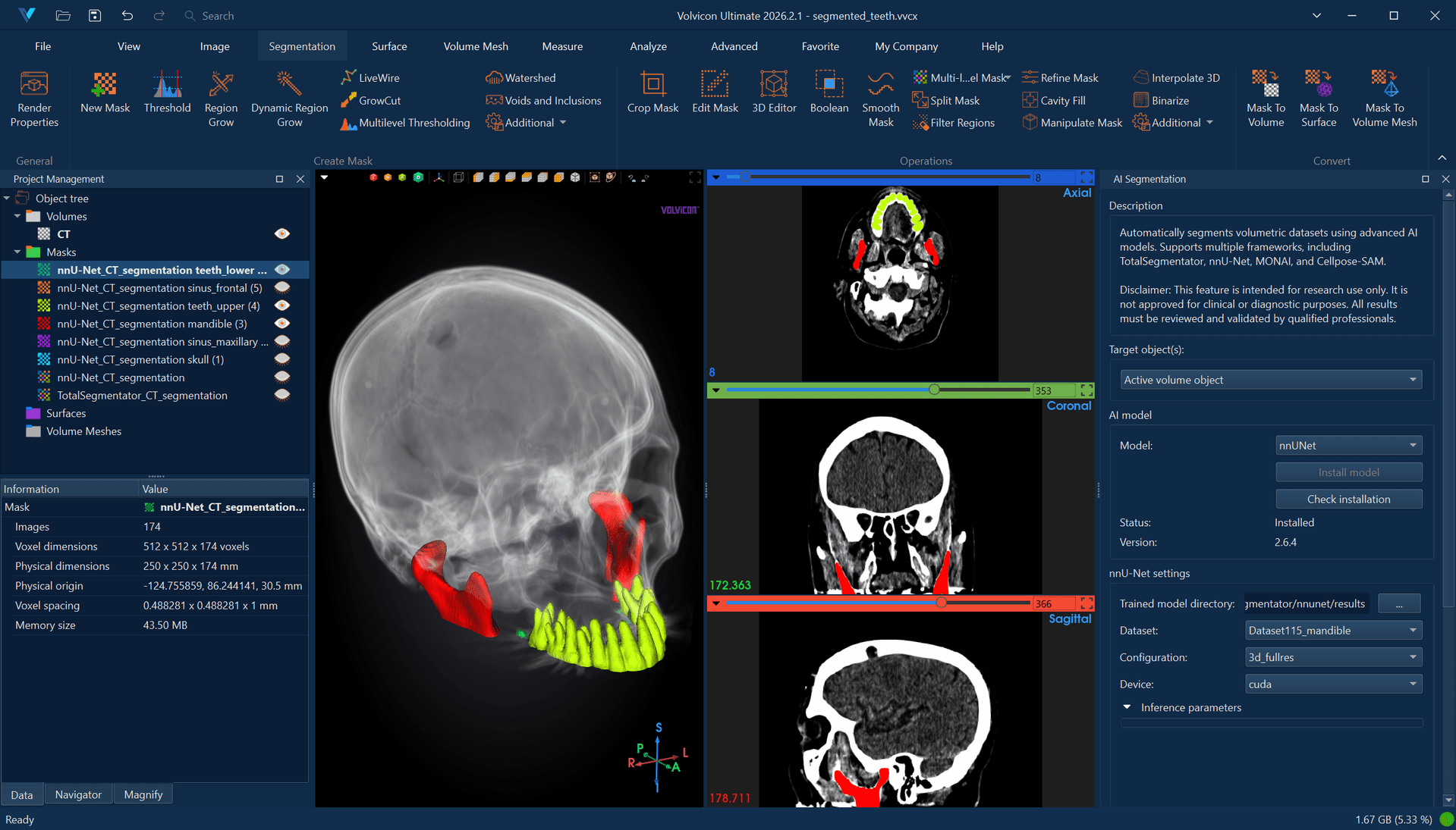 AI Segmentation - nnU-Net