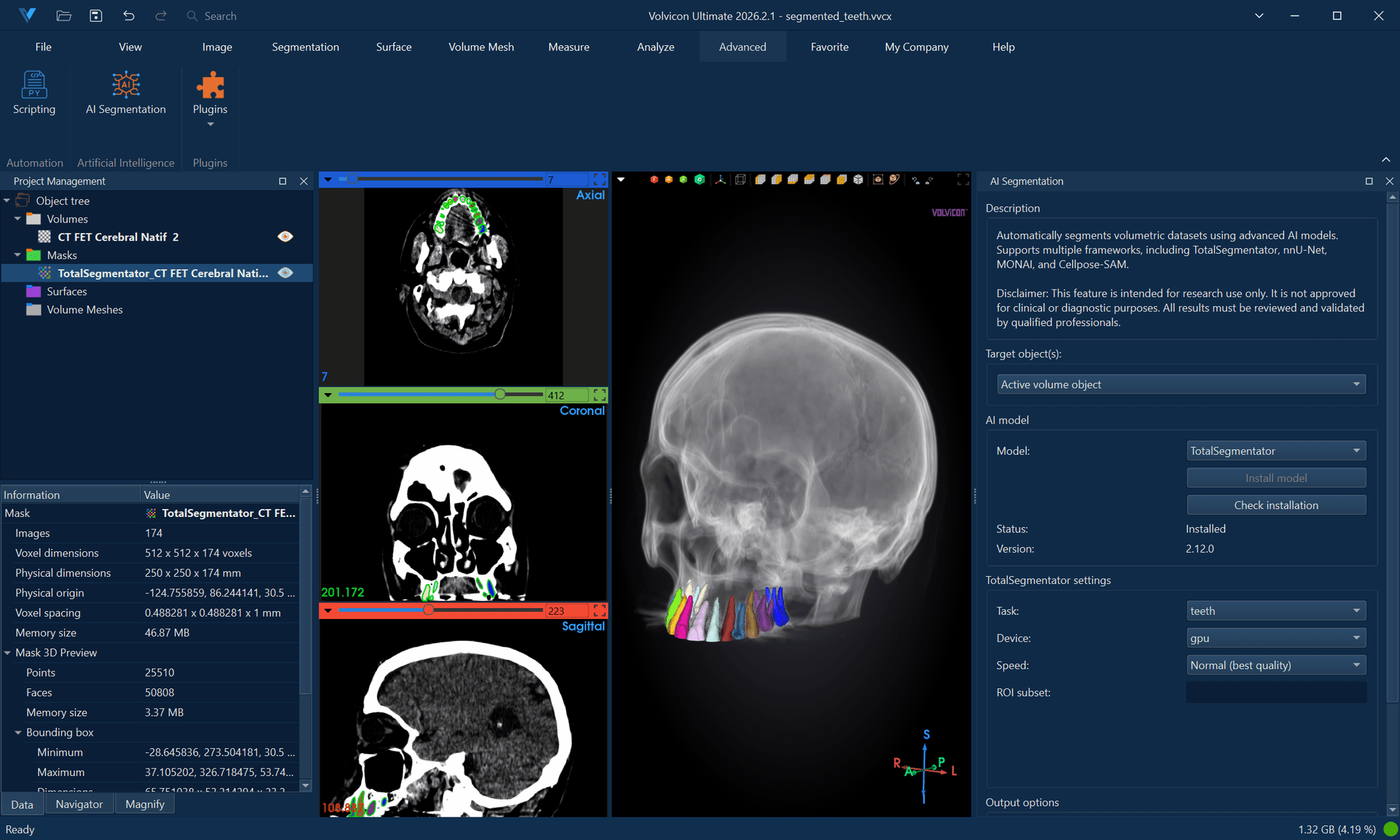 AI Segmentation - TotalSegmentator