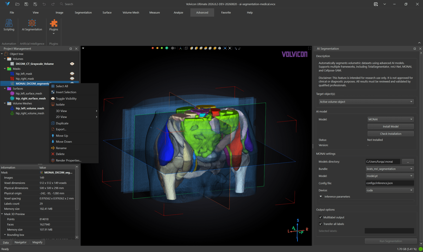 MONAI segmentation result