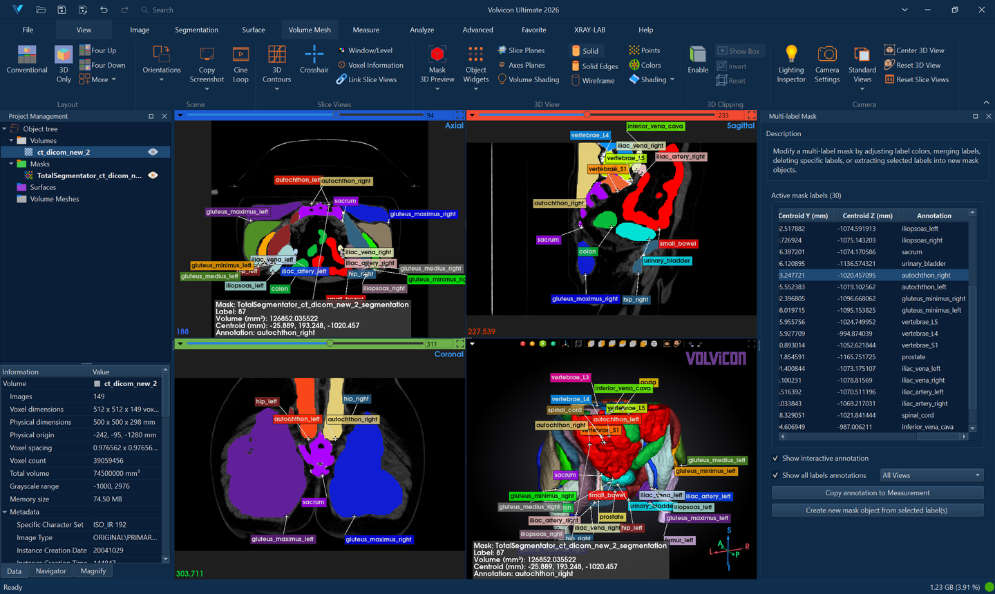 Label Annotation Visualization - AI Segmentation - TotalSegmentator