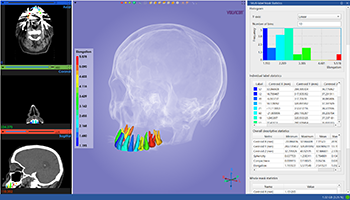 AI-Assisted Segmentation & Automation in Volvicon | TotalSegmentator, nnU-Net, MONAI, Cellpose-SAM